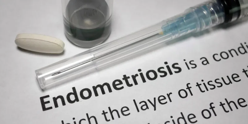Quick Facts: What You Need to Know About Endometriosis